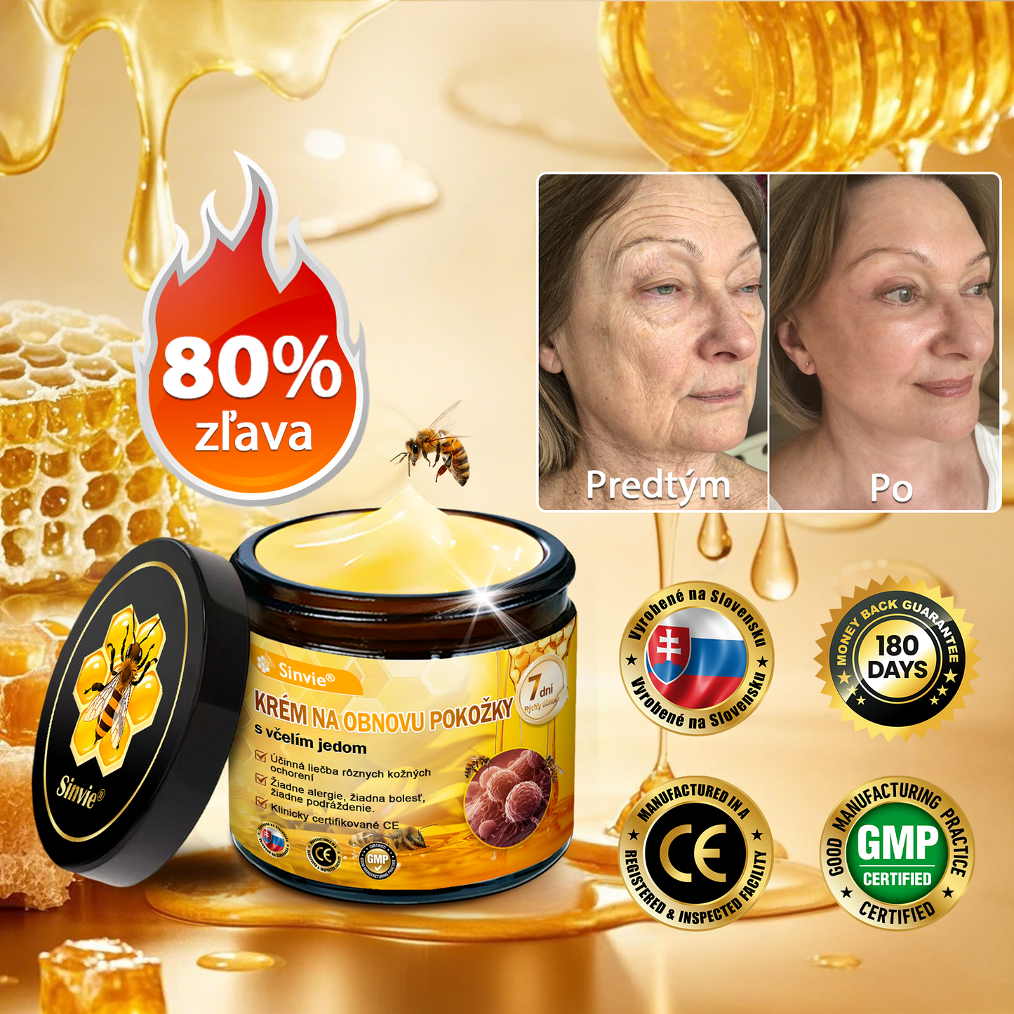 🌻🌻 Sinvie® Krém na obnovu pokožky s včelím jedom 🔥 Odporúčané dermatológmi | Proti vráskam, pigmentovým škvrnám a ochabnutej pokožke – 50 ml
