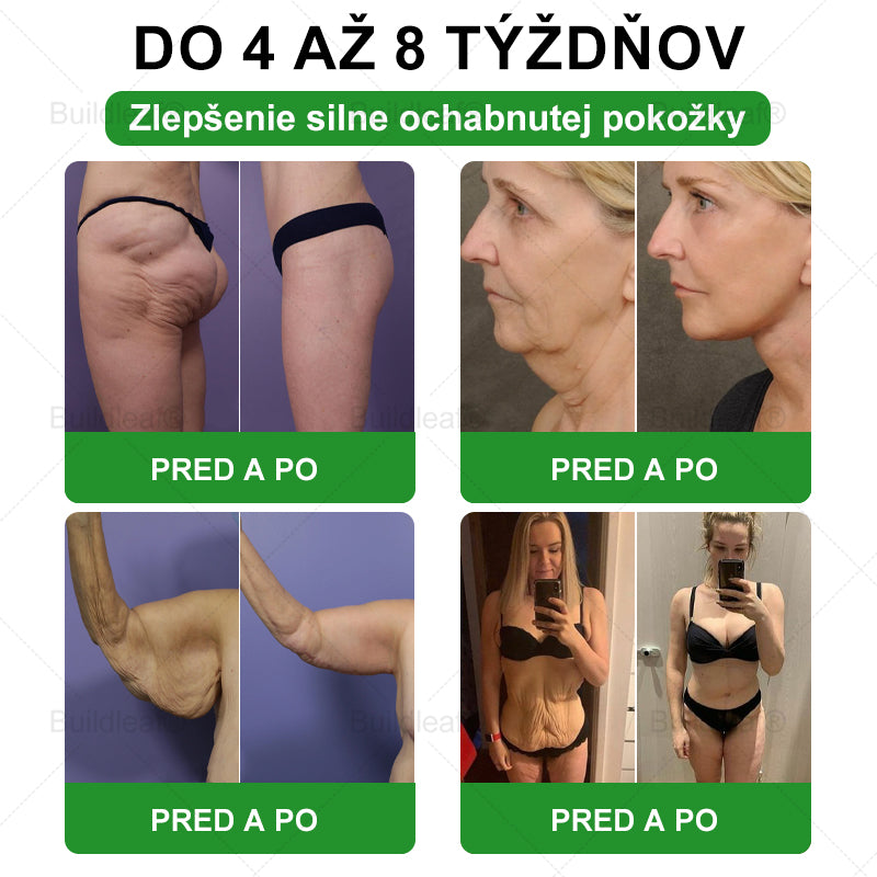 💧💧SVKBuildLeaf® GLP-1 6-v-1 Health Solution Perorálna tekutina (Len raz denne, viditeľné zmeny už za 7 dní) Pre obezitu, kardiovaskulárne ochorenia, cukrovku, spánkové apnoe, zdravie čriev, problémy s kĺbmi a ďalšie