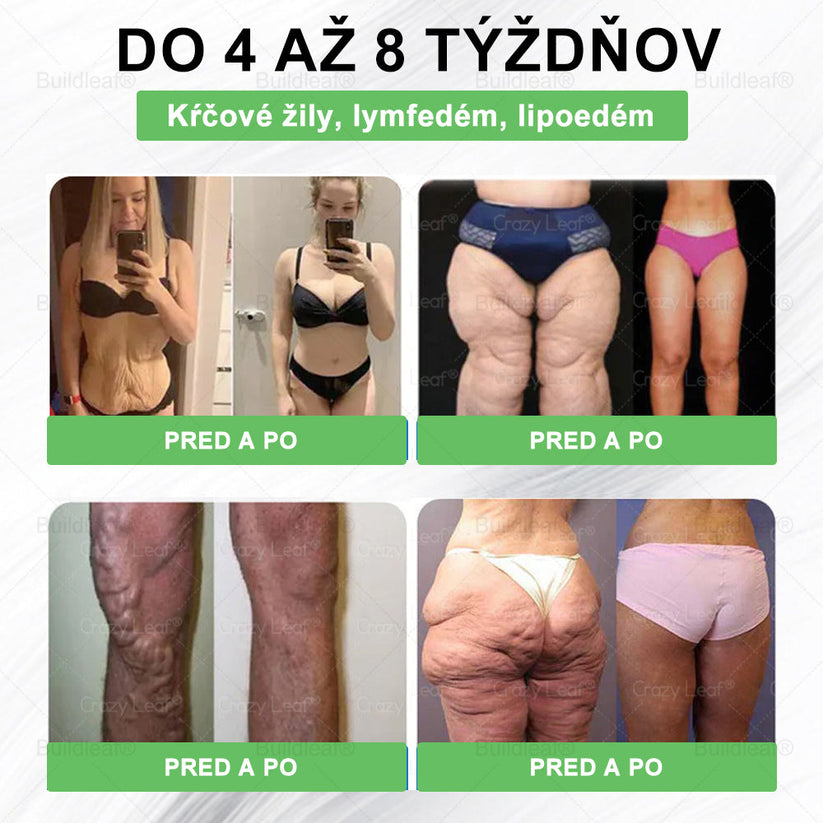 🌱🌱BuildLeaf® GLP-1 8-v-1 Fit & Vital Perorálny Roztok ✅ (Len raz denne, viditeľné zmeny už za 7 dní) Pre obezitu, kardiovaskulárne ochorenia, cukrovku, spánkové apnoe, zdravie čriev, problémy s kĺbmi a ďalšie