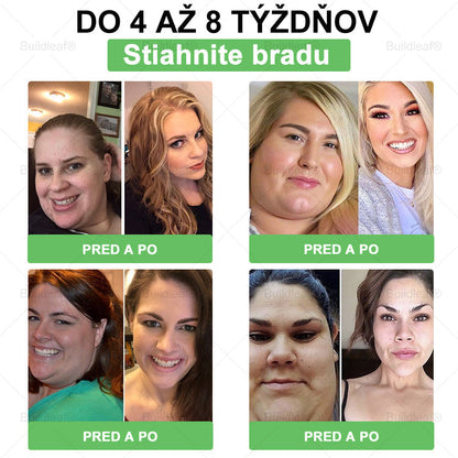 💧💧SVKBuildLeaf® GLP-1 6-v-1 Health Solution Perorálna tekutina (Len raz denne, viditeľné zmeny už za 7 dní) Pre obezitu, kardiovaskulárne ochorenia, cukrovku, spánkové apnoe, zdravie čriev, problémy s kĺbmi a ďalšie